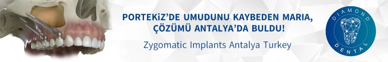 https://diamonddentalantalya.com/