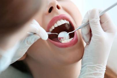 ANTALYA’DA AĞIZ VE DİŞ SAĞLIĞINA FARKINDALIK