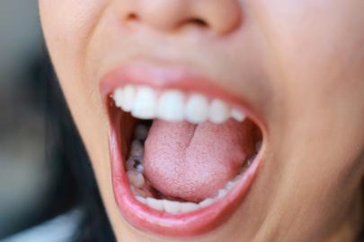 ÖLÜMCÜL HASTALIĞIN ERKEN BELİRTİSİ DİL KASLARINDA ORTAYA ÇIKIYOR