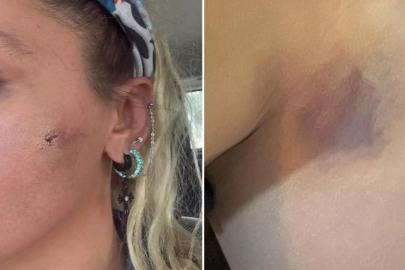 ÜNLÜ İSİMDEN ŞOK İTİRAF: “EŞİM TARAFINDAN DARP EDİLDİM”