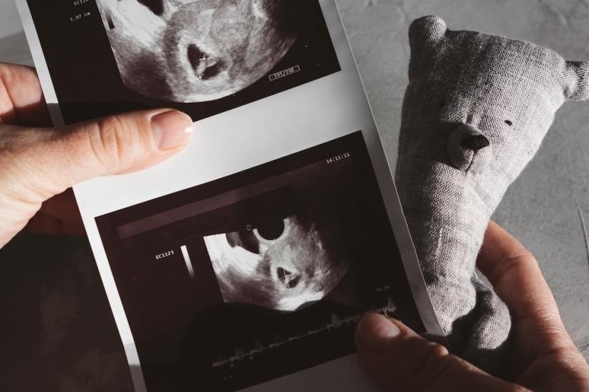 KESEDEN CİNSİYET MERAKI